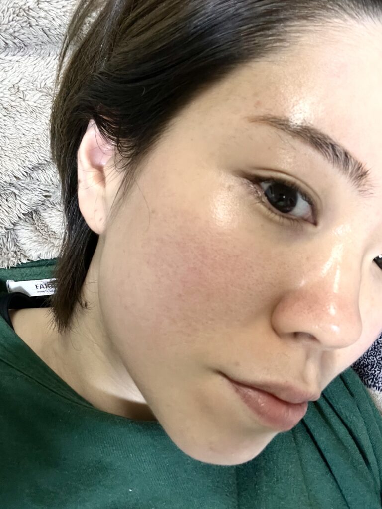 変わってきた私の肌